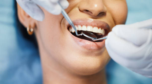 Best Urgent Care for Lost Fillings or Crowns in Lakeland, GA