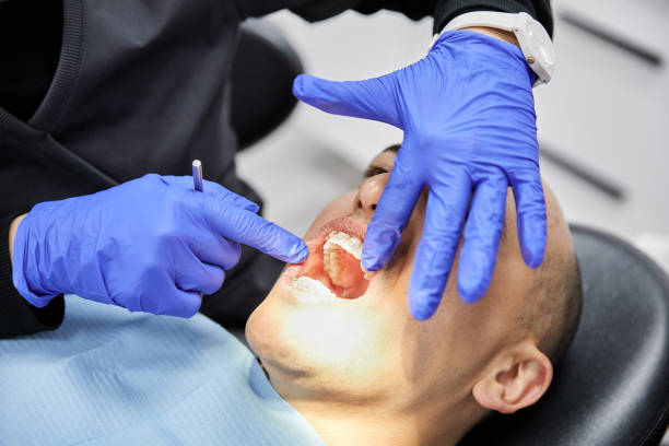 Best Emergency Wisdom Teeth Removal in Lakeland, GA